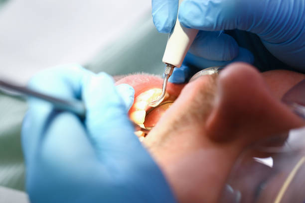Best Emergency Root Canal Treatment in Merrill, WI
