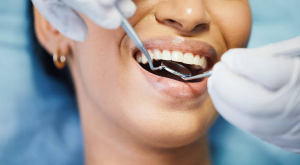 Best Emergency Tooth Extraction in Merrill, WI